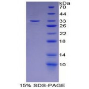 SDS-PAGE analysis of Mouse LCP2 Protein.