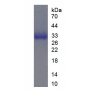 SDS-PAGE analysis of recombinant Human ITGAL/CD11a Protein.