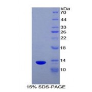 SDS-PAGE analysis of Human Lymphotactin Protein.