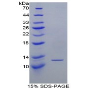 SDS-PAGE analysis of Mouse Lymphotactin Protein.