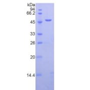 abx067862