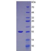 SDS-PAGE analysis of recombinant Chicken Lysozyme Protein.