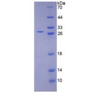 SDS-PAGE analysis of Human LOXL1 Protein.