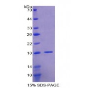 SDS-PAGE analysis of Human LOXL1 Protein.