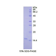 SDS-PAGE analysis of Human LOXL2 Protein.
