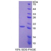 SDS-PAGE analysis of Human LOXL4 Protein.