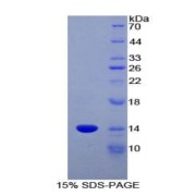 SDS-PAGE analysis of Rat CCL6 Protein.