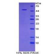 SDS-PAGE analysis of Rat PRG2 Protein.