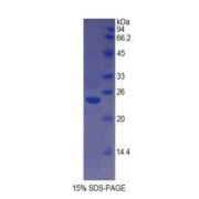 SDS-PAGE analysis of Cow HLA-DRA Protein.
