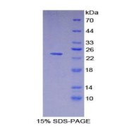 SDS-PAGE analysis of Pig HLA-DRA Protein.