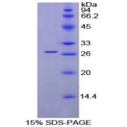 SDS-PAGE analysis of Chicken Malectin Protein.