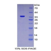 SDS-PAGE analysis of Mouse MRC1 Protein.