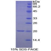 SDS-PAGE analysis of recombinant Mouse Matrix Gla Protein.