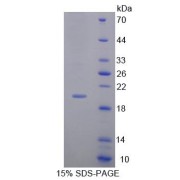 SDS-PAGE analysis of Rabbit MMP13 Protein.