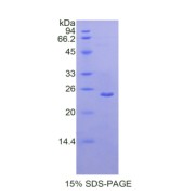 SDS-PAGE analysis of Human MMP13 Protein.