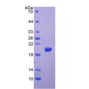 SDS-PAGE analysis of recombinant Human Matrix Metalloproteinase 9 (MMP9) Protein.