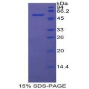SDS-PAGE analysis of recombinant Mouse MCP.