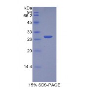 SDS-PAGE analysis of Human MPST Protein.