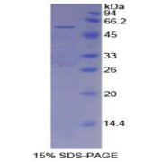 SDS-PAGE analysis of Mouse Mesothelin Protein.