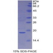 SDS-PAGE analysis of Human Metallothionein 2 Protein.