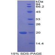 SDS-PAGE analysis of recombinant Human MFAP5 Protein.