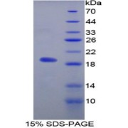 SDS-PAGE analysis of Rat MFAP5 Protein.