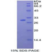 SDS-PAGE analysis of recombinant Human MAPK11 Protein.
