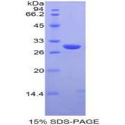 SDS-PAGE analysis of Human Moesin Protein.