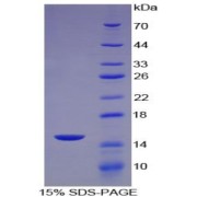 SDS-PAGE analysis of Human MCP2 Protein.