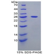 SDS-PAGE analysis of Mouse Smad1 Protein.
