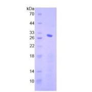 SDS-PAGE analysis of Human Smad4 Protein.