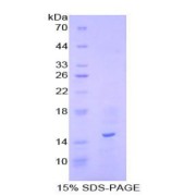 SDS-PAGE analysis of Human Promotilin Protein.