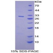 SDS-PAGE analysis of Mouse MUSK Protein.