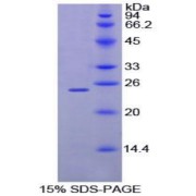 SDS-PAGE analysis of Mouse MPL Protein.