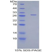 SDS-PAGE analysis of Human Myocilin Protein.