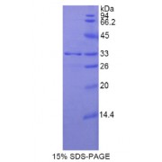 SDS-PAGE analysis of Rat MYH11 Protein.