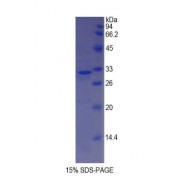 SDS-PAGE analysis of Human MYH14 Protein.