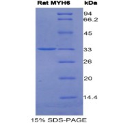 SDS-PAGE analysis of Rat MYH6 Protein.