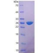 SDS-PAGE analysis of Rat MYH6 Protein.