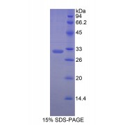 SDS-PAGE analysis of recombinant Human MYH7 Protein.