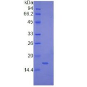 SDS-PAGE analysis of Human MYL1 Protein.