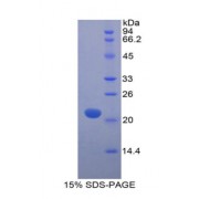 SDS-PAGE analysis of Human Myosin Light Chain 12A Protein.