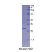 SDS-PAGE analysis of Human MYL4 Protein.