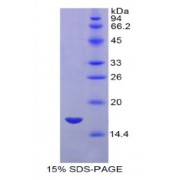 SDS-PAGE analysis of Human MYL7 Protein.
