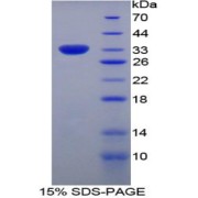 SDS-PAGE analysis of Human MX1 Protein.