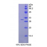 SDS-PAGE analysis of Human NAAA Protein.