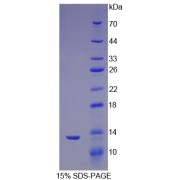 SDS-PAGE analysis of Mouse Nephrin Protein.