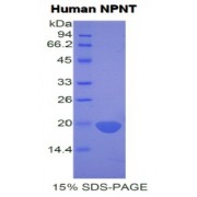 SDS-PAGE analysis of Human Nephronectin Protein.