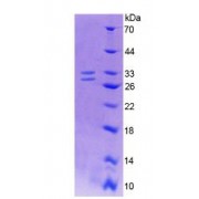 SDS-PAGE analysis of Human Nerve Growth Factor Protein.
