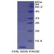 SDS-PAGE analysis of Human Nesfatin 1 Protein.